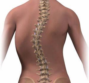 scoliosis therapy dubai