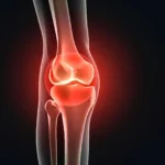 joint pain treatment dubai
