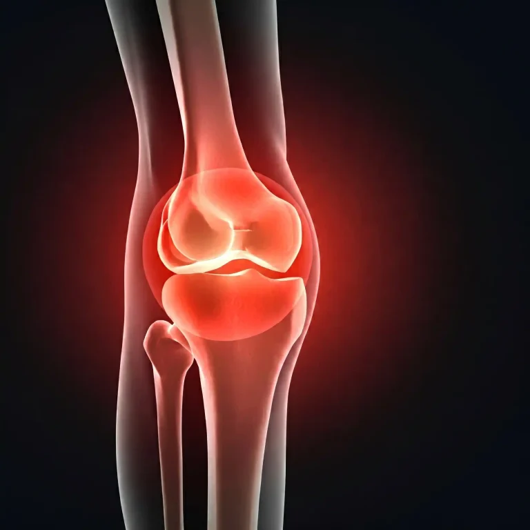 joint pain treatment dubai